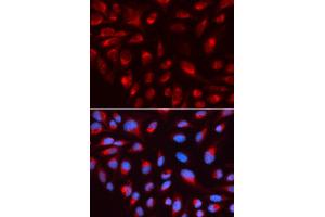 Immunofluorescence analysis of U2OS cell using CTBP1 antibody. (CTBP1 Antikörper)