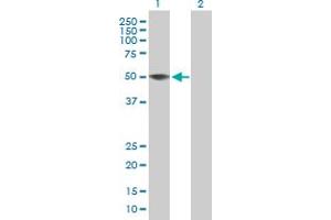 Western Blot analysis of ZCCHC12 expression in transfected 293T cell line by ZCCHC12 MaxPab polyclonal antibody. (ZCCHC12 Antikörper  (AA 1-402))
