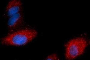 Immunofluorescence (IF) image for anti-Fatty Acid Binding Protein 4, Adipocyte (FABP4) (AA 1-132) antibody (PE) (ABIN5567676) (FABP4 Antikörper  (AA 1-132) (PE))