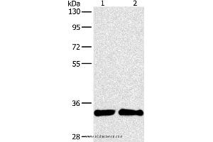 Western blot analysis of A431 and 231 cell, using ARTN Polyclonal Antibody at dilution of 1:350 (ARTN Antikörper)