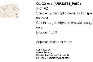 Sample Type: Human Optic Nerve and Spinal CordCellular Target: Oligoden Drocyte Lineage CellsDilution: 1:500 (OLIG2 Antikörper  (C-Term))