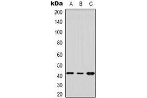 Western blot analysis of DUSP9 expression in Hela (A), HEK293T (B), NIH3T3 (C) whole cell lysates. (DUSP9 Antikörper)