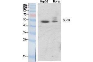 Western Blotting (WB) image for anti-Glucagon-Like Peptide 1 Receptor (GLP1R) (Internal Region) antibody (ABIN3184801) (GLP1R Antikörper  (Internal Region))