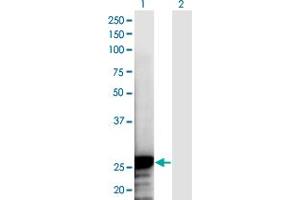 Western Blot analysis of NOL3 expression in transfected 293T cell line by NOL3 monoclonal antibody (M03A), clone 6F5. (NOL3 Antikörper  (AA 1-208))