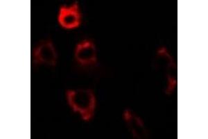 Immunofluorescent analysis of ERp5 staining in U2OS cells.