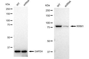 Western blotting analysis using RRM1 antibody (ABIN7800212). (Rekombinanter RRM1 Antikörper)