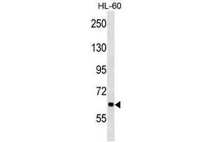 ANKHD1 Antibody (N-term) western blot analysis in HL-60 cell line lysates (35µg/lane). (ANKHD1 Antikörper  (N-Term))