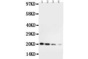 Anti-mouse IL10 antibody, Western blotting Lane 1: Recombinant Mouse IL10 Protein 10ng Lane 2: Recombinant Mouse IL10 Protein 5ng Lane 3: Recombinant Mouse IL10 Protein 2 (IL-10 Antikörper  (AA 19-178))