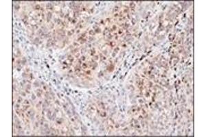 Immunohistochemistry (IHC) image for anti-Melanosome (C-Term) antibody (ABIN870422) (Melanosome (C-Term) Antikörper)