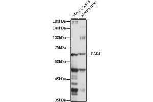 Western blot analysis of extracts of various cell lines, using P antibody (ABIN6130472, ABIN6145188, ABIN6145189 and ABIN6215336) at 1:1000 dilution.