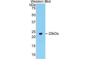 Detection of Recombinant PPARg, Rat using Polyclonal Antibody to Peroxisome Proliferator Activated Receptor Gamma (PPARg) (PPARG Antikörper  (AA 311-493))