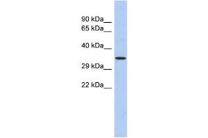 WB Suggested Anti-PRDM12 Antibody Titration: 0. (PRDM12 Antikörper  (N-Term))