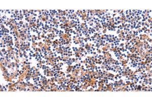 Immunohistochemistry of paraffin-embedded Human tonsil tissue using COL20A1 Polyclonal Antibody at dilution 1:40 (COL20A1 Antikörper)