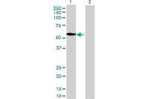 Western Blotting (WB) image for METTL4 293T Cell Transient Overexpression Lysate(Denatured) (ABIN1337542)