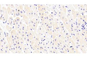 Detection of PAM in Human Cardiac Muscle Tissue using Polyclonal Antibody to Peptidylglycine Alpha Amidating Monooxygenase (PAM) (PAM Antikörper  (AA 21-288))