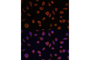 Immunofluorescence analysis of L929 cells using ZCCHC3 antibody (ABIN7271543) at dilution of 1:100. (ZCCHC3 Antikörper  (AA 215-335))