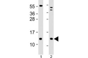 Western blot testing of human 1) human brain and 2) LNCaP cell lysate with C18orf32 antibody at 1:2000.