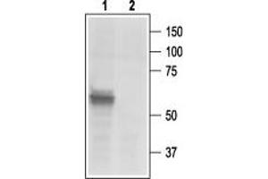 Western blot analysis of rat DRG lysates: - 1. (P2X3 Receptor (AA 383-397), (C-Term), (Intracellular) Antikörper)