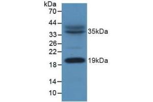 Figure. (NDUFAB1 Antikörper  (AA 5-129))