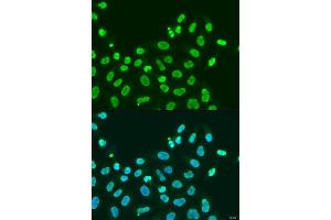 Immunofluorescence analysis of U2OS cells using CBX5 antibody. (CBX5 Antikörper  (AA 1-100))