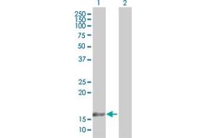 Western Blot analysis of TAF12 expression in transfected 293T cell line by TAF12 MaxPab polyclonal antibody. (TAF12 Antikörper  (AA 1-161))