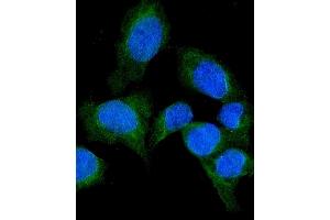 IF analysis of SFRP1 using anti-SFRP1 antibody (ABIN6719484).