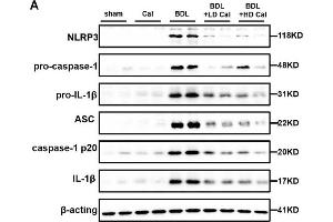 Calcipotriol supplement inhibits the NLRP3 inflammasome activation during DDC-induced and BDL-induced cholestatic liver injury. (NLRP3 Antikörper  (C-Term))