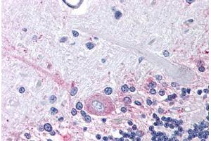 Immunohistochemistry (IHC) image for anti-Prostaglandin E Receptor 3 (Subtype EP3) (PTGER3) (Cytoplasmic Domain) antibody (ABIN213638)