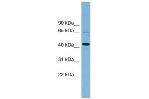 UEVLD antibody used at 1 ug/ml to detect target protein. (UEVLD Antikörper  (Middle Region))
