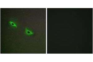 Immunofluorescence (IF) image for anti-Cytochrome P450, Family 2, Subfamily S, Polypeptide 1 (CYP2S1) (AA 181-230) antibody (ABIN2889949) (CYP2S1 Antikörper  (AA 181-230))