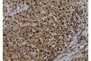 ABIN6277702 at 1/100 staining Human liver tissue by IHC-P. (GSTP1 Antikörper  (N-Term))
