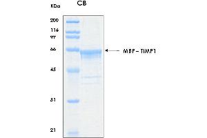 10% SDS-PAGE stained with Coomassie Blue (CB) and peptide fingerprinting by MALDI-TOF mass spectrometry (TIMP1 Protein (AA 1-207) (MBP tag))