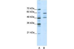 Human Jurkat; WB Suggested Anti-TFCP2L1 Antibody Titration: 0. (TFCP2L1 Antikörper  (Middle Region))