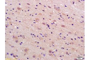 Formalin-fixed and paraffin embedded rat brain labeled with Rabbit Anti phospho-LRP1(Ser4523) Polyclonal Antibody, Unconjugated (ABIN801648) at 1:200 followed by conjugation to the secondary antibody and DAB staining (LRP1 Antikörper  (pSer4523))
