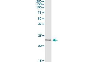 Immunoprecipitation (IP) image for anti-Copper Metabolism (Murr1) Domain Containing 1 (COMMD1) (AA 1-190) antibody (ABIN531007)