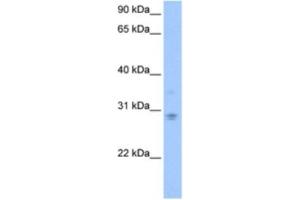 Western Blotting (WB) image for anti-DCN1, Defective in Cullin Neddylation 1, Domain Containing 3 (DCUN1D3) antibody (ABIN2463546) (DCUN1D3 Antikörper)