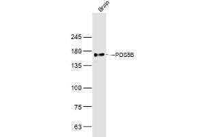 Mouse brain lysates probed with PDS5B Polyclonal Antibody, Unconjugated  at 1:300 dilution and 4˚C overnight incubation. (PDS5B Antikörper  (AA 1051-1150))
