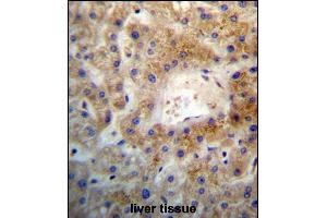 SGEF Antibody (Center) (ABIN657248 and ABIN2846346) immunohistochemistry analysis in formalin fixed and paraffin embedded human liver tissue followed by peroxidase conjugation of the secondary antibody and DAB staining. (SGEF Antikörper  (AA 378-406))