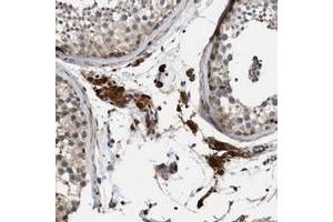 Immunohistochemical staining of human testis with SLC4A11 polyclonal antibody  shows strong positivity in Leydig cells.