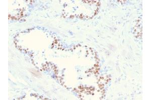 Immunohistochemistry (IHC) image for anti-NK3 Homeobox 1 (NKX3-1) (AA 92-224) antibody (ABIN6940210)