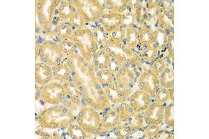 Immunohistochemistry of paraffin-embedded mouse kidney using MOCS3 antibody at dilution of 1:100 (x400 lens). (MOCS3 Antikörper)