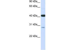 GCDH antibody used at 1 ug/ml to detect target protein. (GCDH Antikörper  (N-Term))
