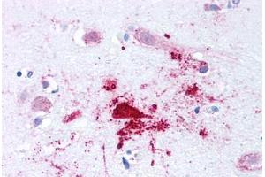 Human Brain, Alzheimers (formalin-fixed, paraffin-embedded) stained with BACE1 antibody ABIN213580 at 2. (BACE1 Antikörper  (N-Term))