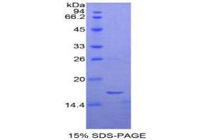 SDS-PAGE (SDS) image for Uromodulin (UMOD) (AA 30-150) protein (His tag) (ABIN2127172)