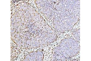 IHC analysis of ARL6IP6 using anti-ARL6IP6 antibody (ABIN7603020). (ARL6IP6 Antikörper  (Middle Region))