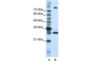 WB Suggested Anti-FUSIP1 Antibody Titration:  0. (SRSF10 Antikörper  (C-Term))