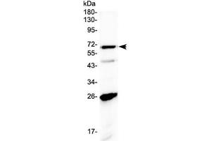 Western blot testing of human A431 cell lysate with SLC7A3 antibody at 0. (SLC7A3 Antikörper  (AA 1-30))