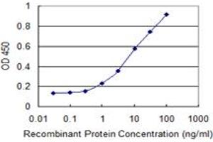 Detection limit for recombinant GST tagged IKBKB is 0. (IKBKB Antikörper  (AA 3-120))