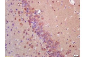 Formalin-fixed and paraffin embedded rat brain labeled with Anti-EIF2AK2/PKR Polyclonal Antibody, Unconjugated (ABIN687307) at 1:200 followed by conjugation to the secondary antibody and DAB staining