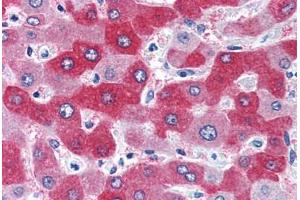 Human Liver (formalin-fixed, paraffin-embedded) stained with FTCD antibody ABIN351477 at 3. (FTCD Antikörper  (AA 203-216))